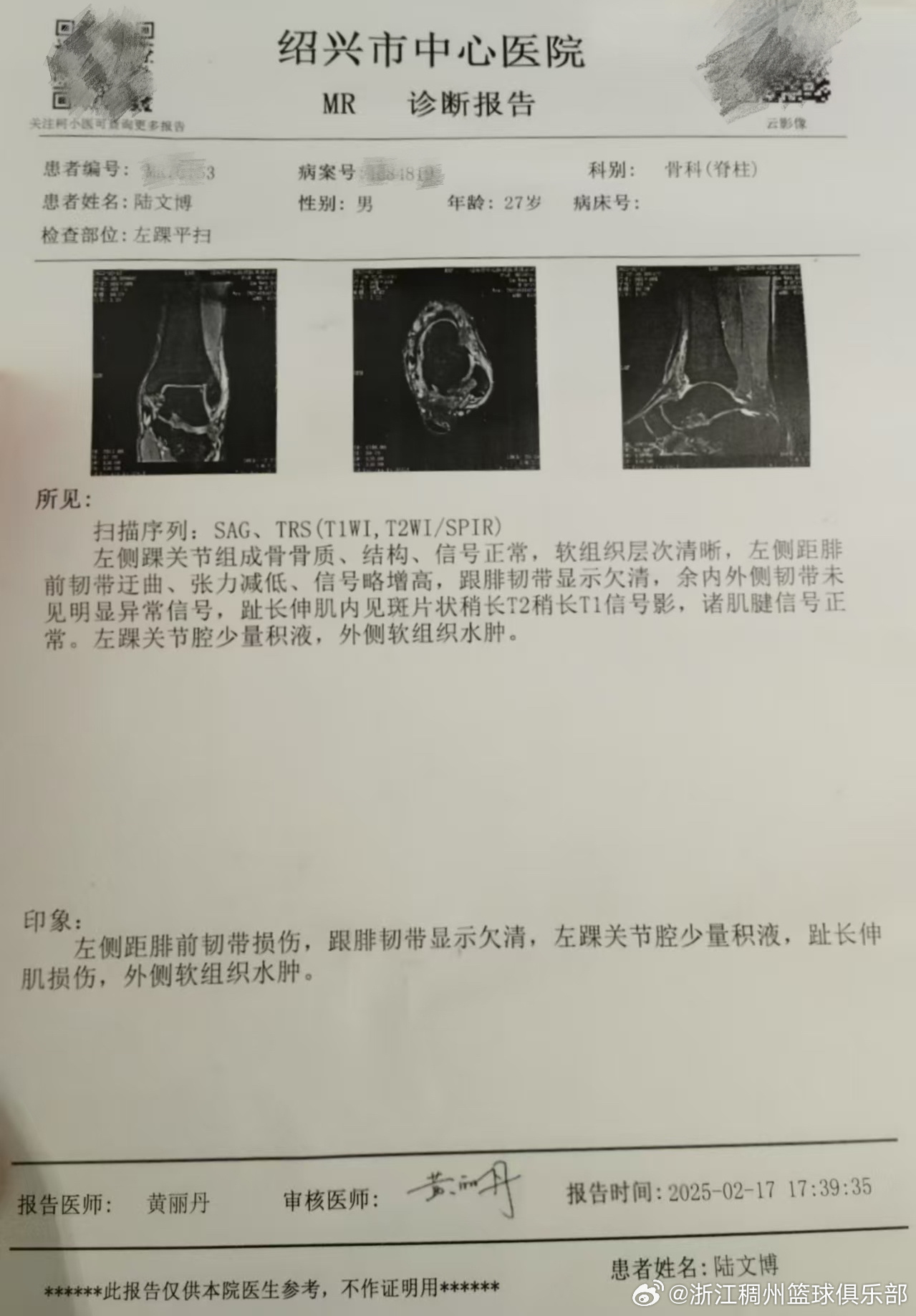 利物浦转会